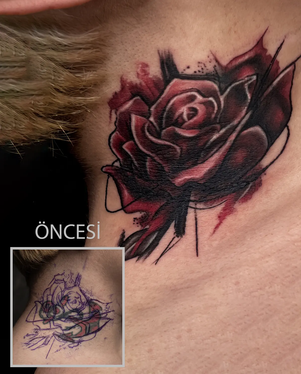 Boyundaki eski dövmenin gül tasarımıyla kapatıldığı cover up dövme