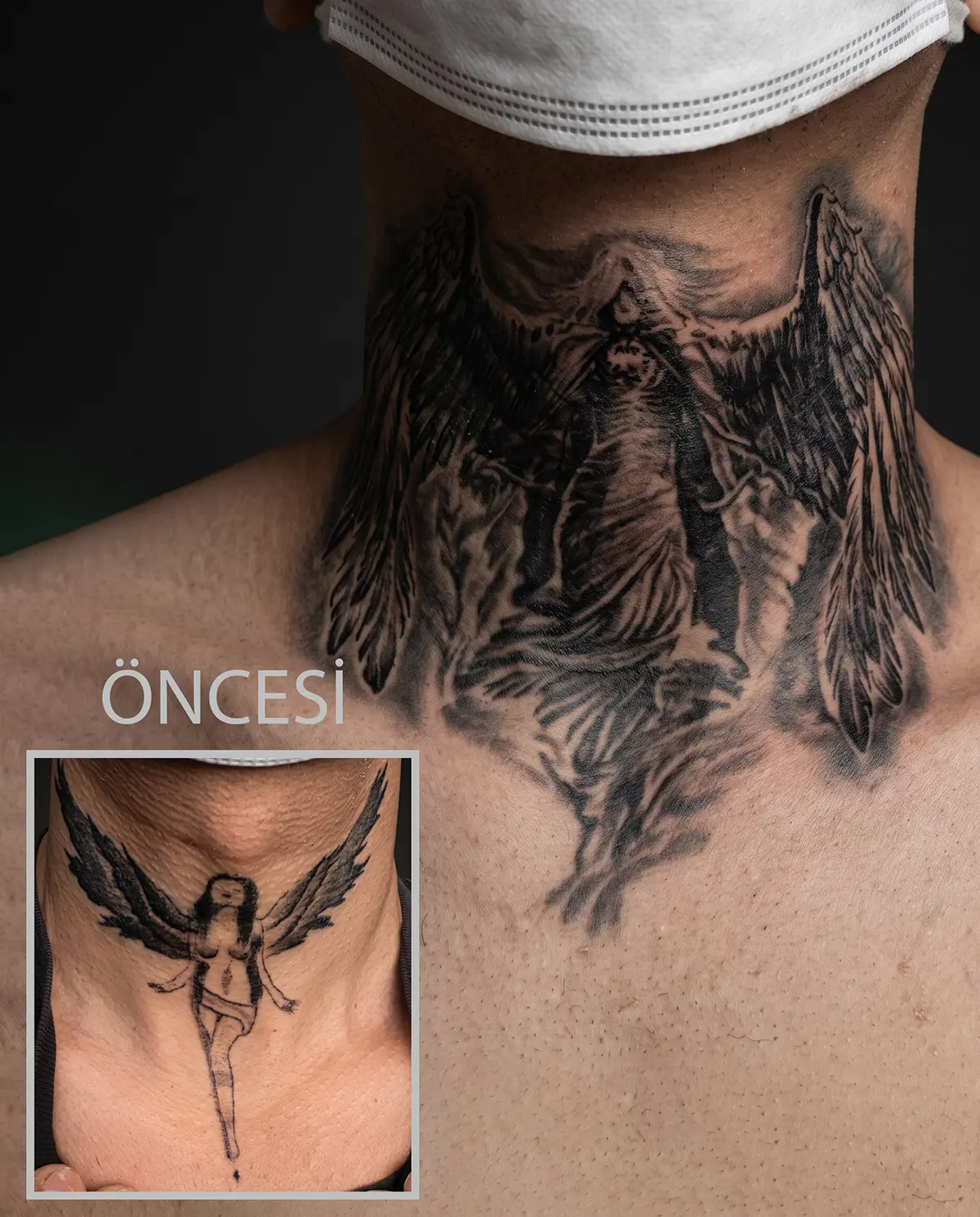 Boyundaki eski dövmenin melek tasarımıyla kapatıldığı cover up çalışması