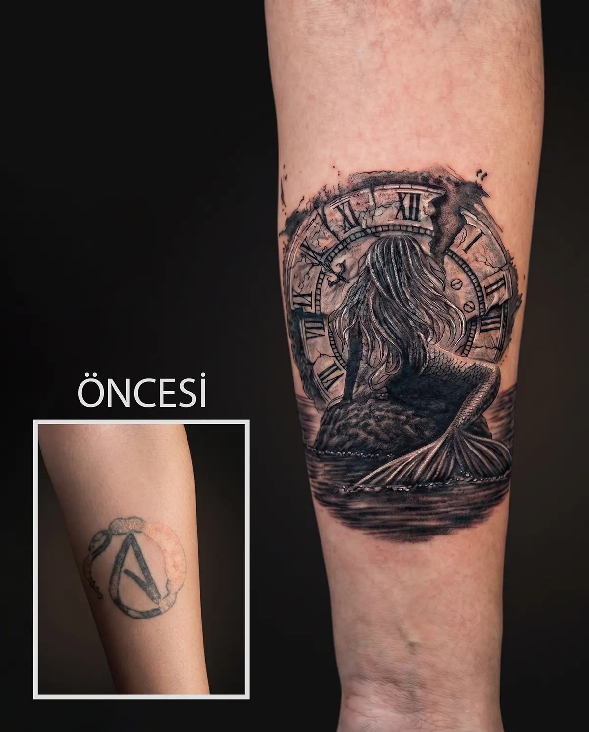 Eski dövmenin deniz kızı ve saat temalı tasarımla kapatıldığı cover up çalışması