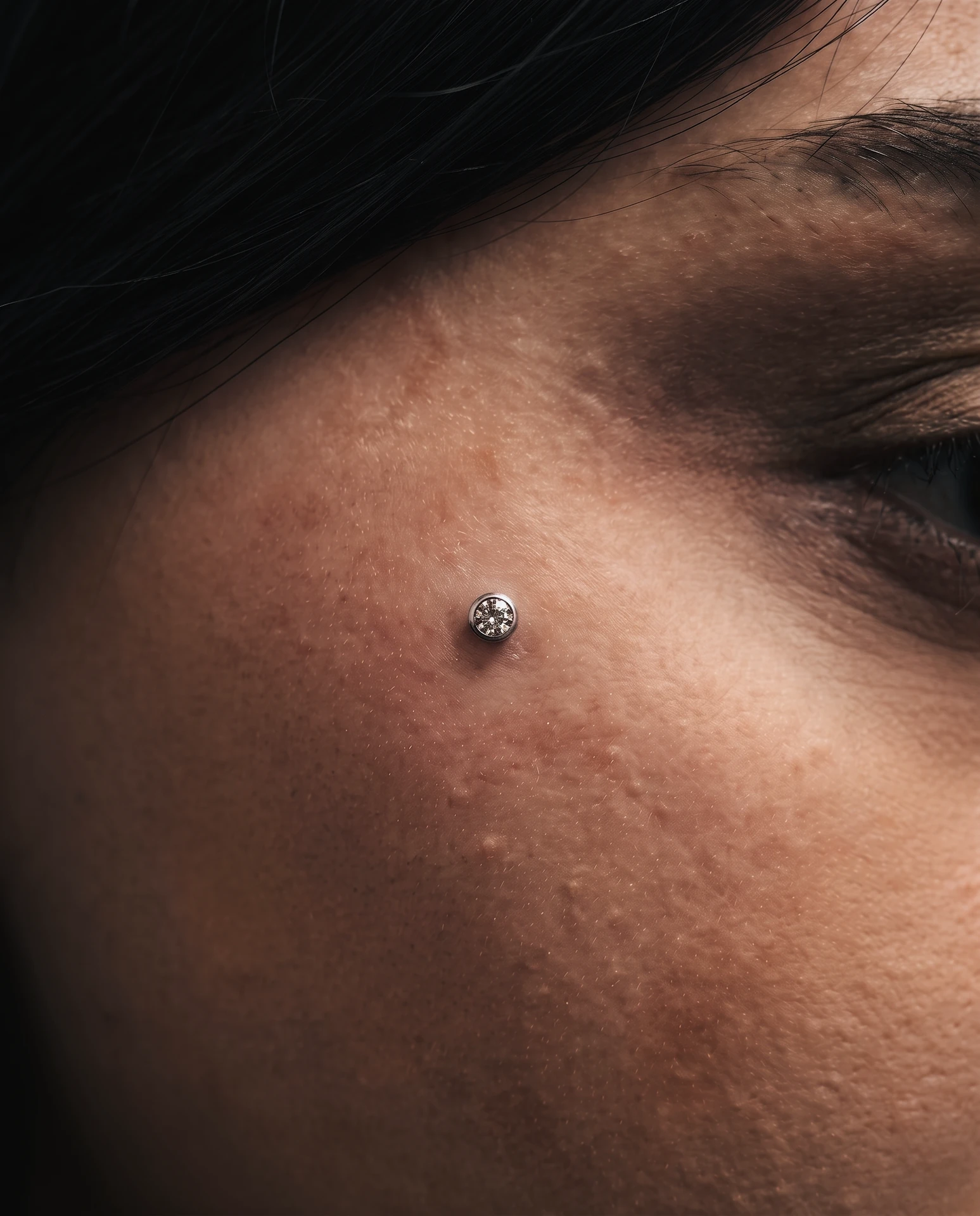 Yanak bölgesinde dermal piercing uygulaması
