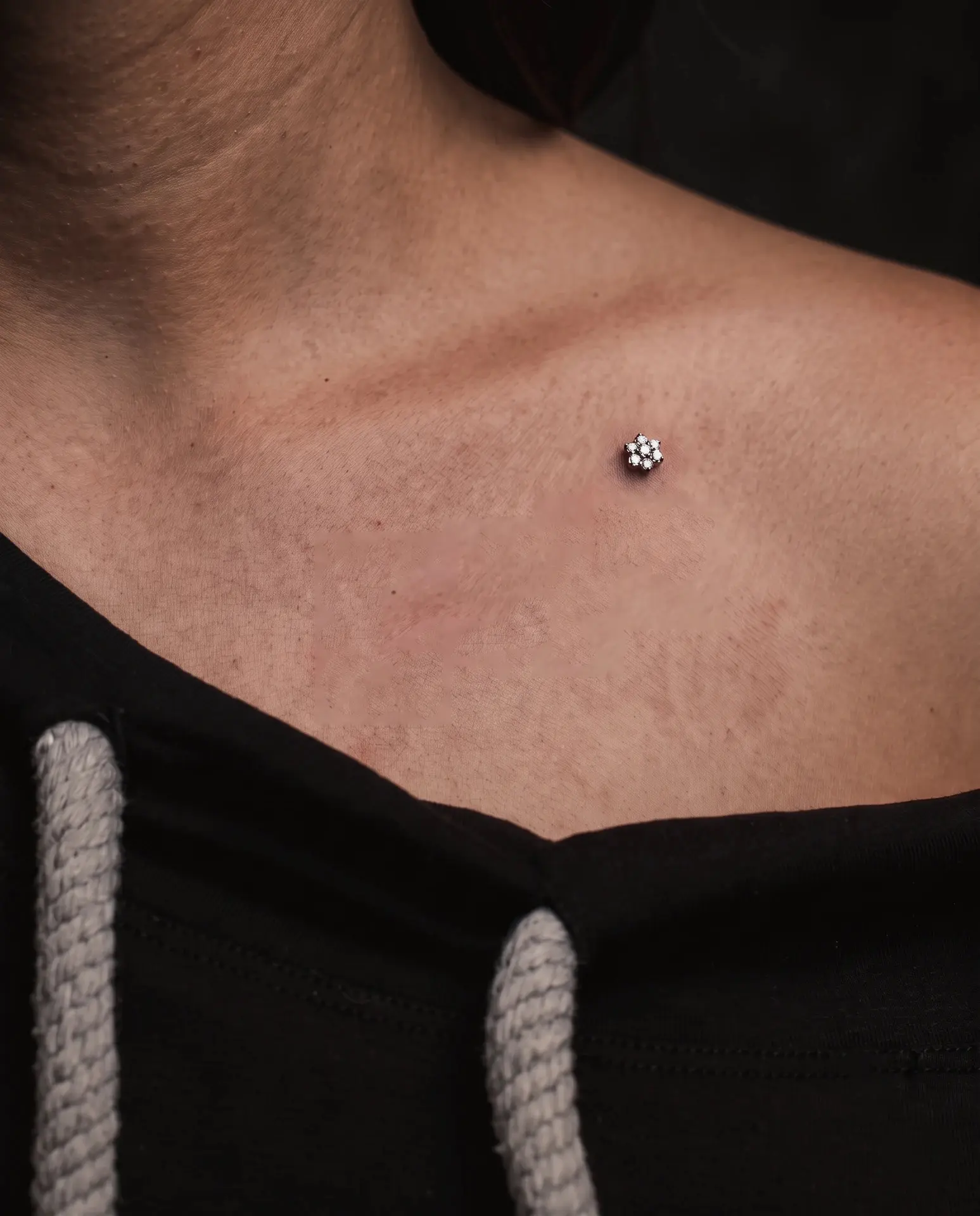 İyileşmiş dermal piercing görünümü