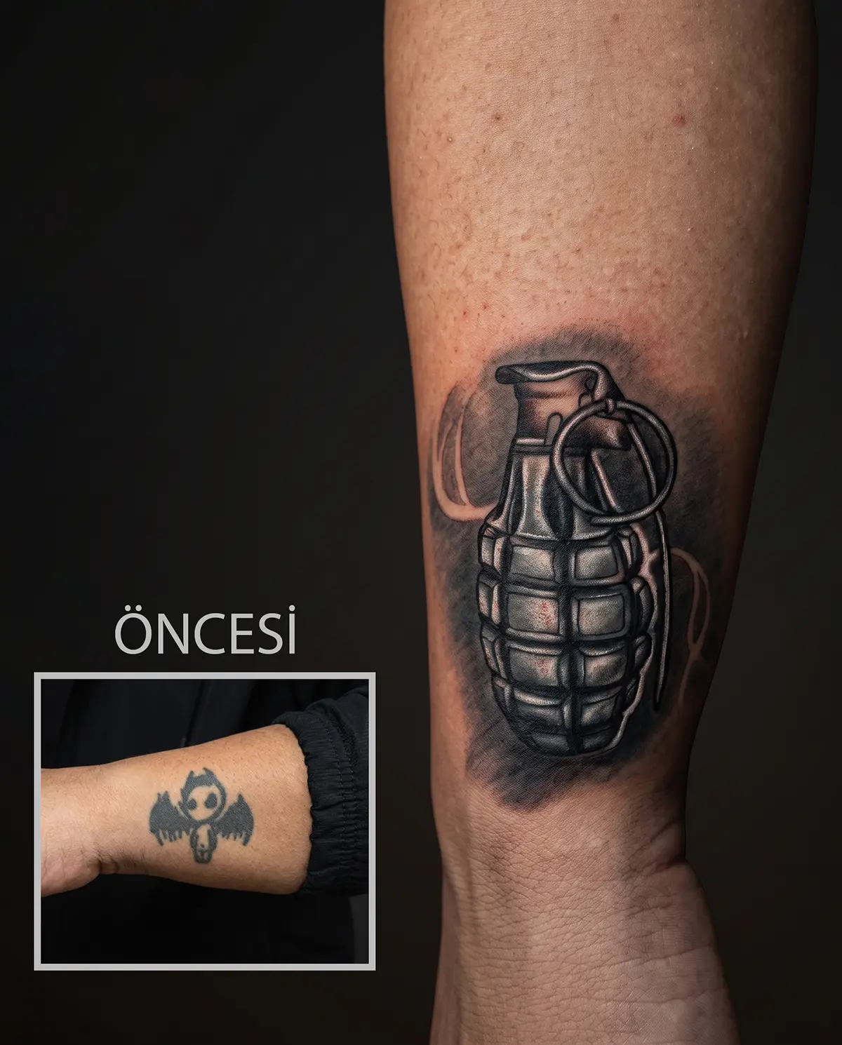 Eski dövmenin el bombası tasarımıyla kapatıldığı cover up çalışması