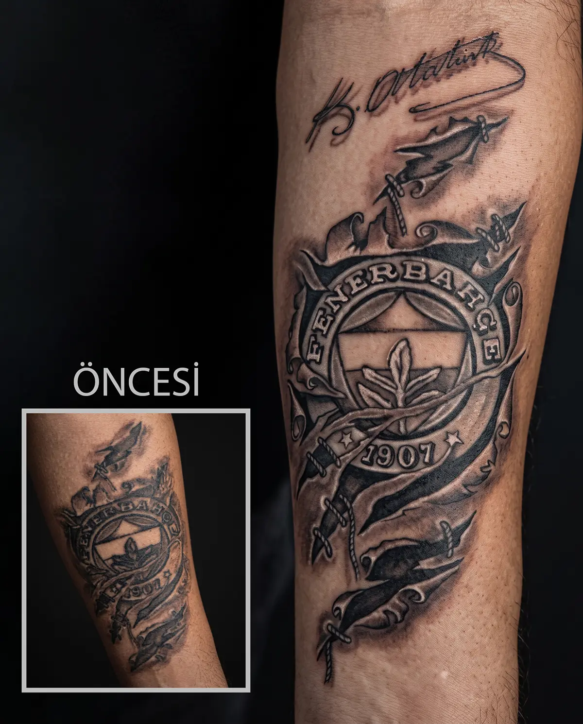 Eski dövmenin Fenerbahçe temalı tasarımla yenilendiği cover up çalışması