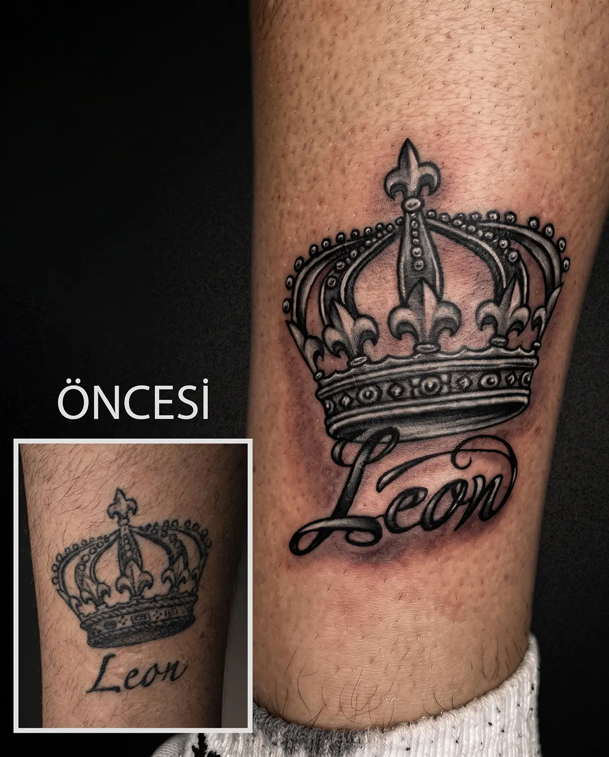 Eski dövmenin taç tasarımıyla kapatıldığı cover up dövme çalışması